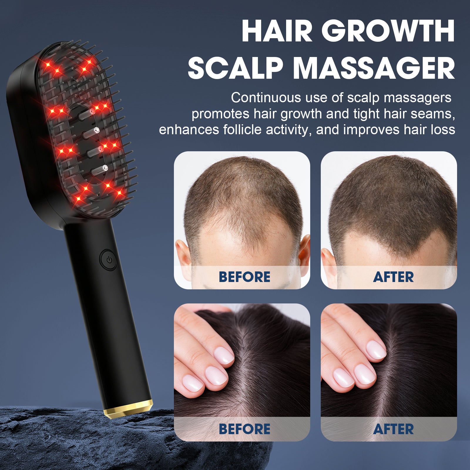 Multi-functional Laser Hair Growth Comb, Red Light