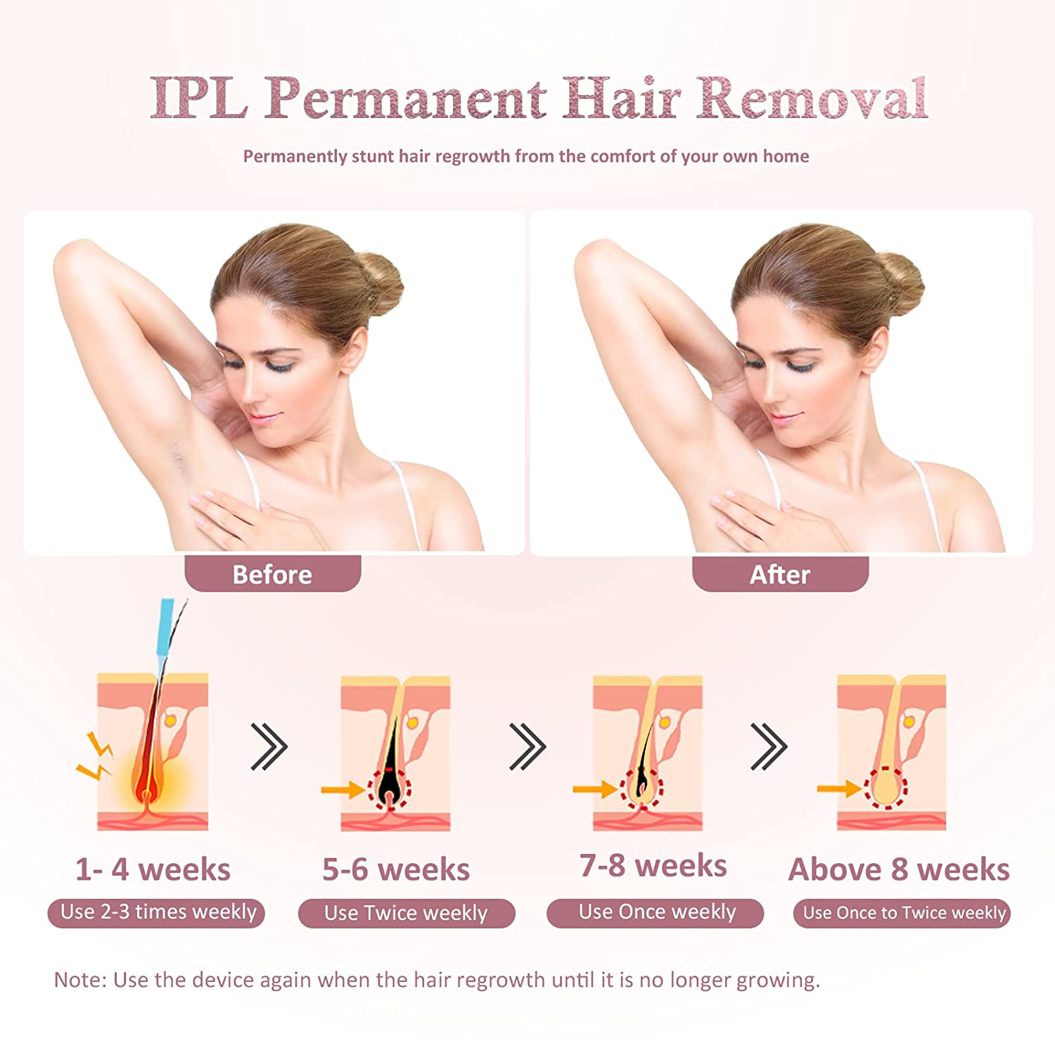 Handheld IPL Ice Hair Removal Device US Plug