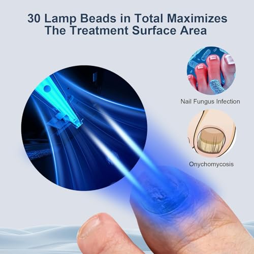 CENYEDA Dispositivo de limpieza de hongos en las u