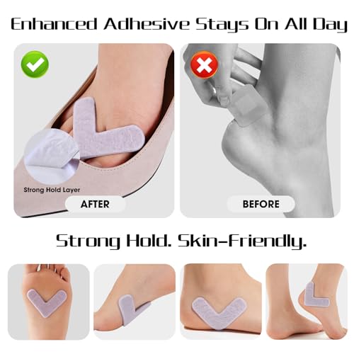 Almofadas de calo cortadas para ajuste, almofadas