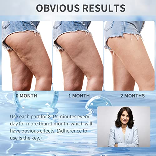 VUEYAA Cellulite Massager Body Sculpting Machine,