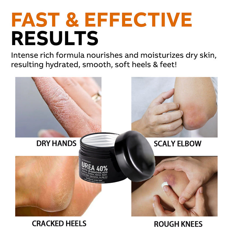 40% Urea Cream for Deep Moisture on Dry, Cracked Skin
