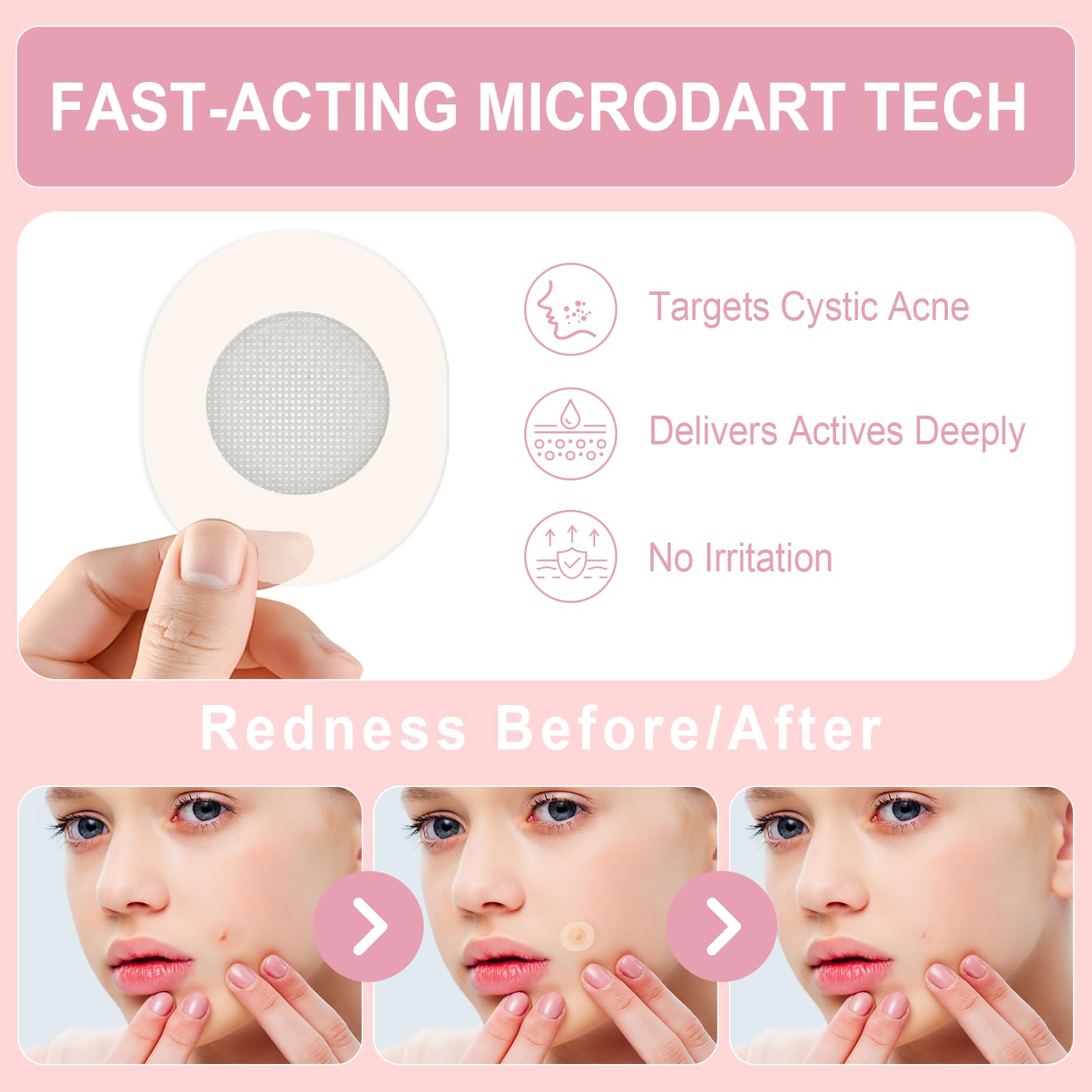 Acne Patch Kit – 3-Step Pimple & Hydrocolloid Patch Set