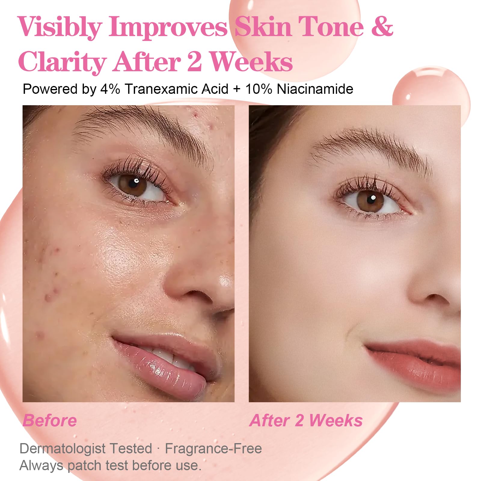 Niacinamide Serum 10% + Tranexamic Acid Serum 4%, Arbutin 2%,Niacinamide 10%, Hydrating & Brightening 30ml