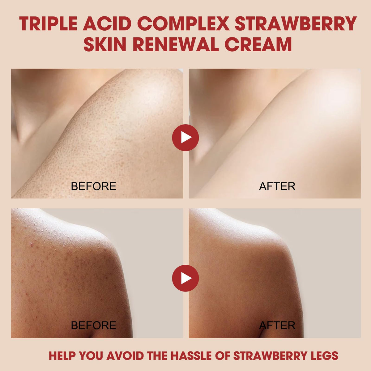 Strawberry Skin Cream with AHA BHA PHA, Hydrating