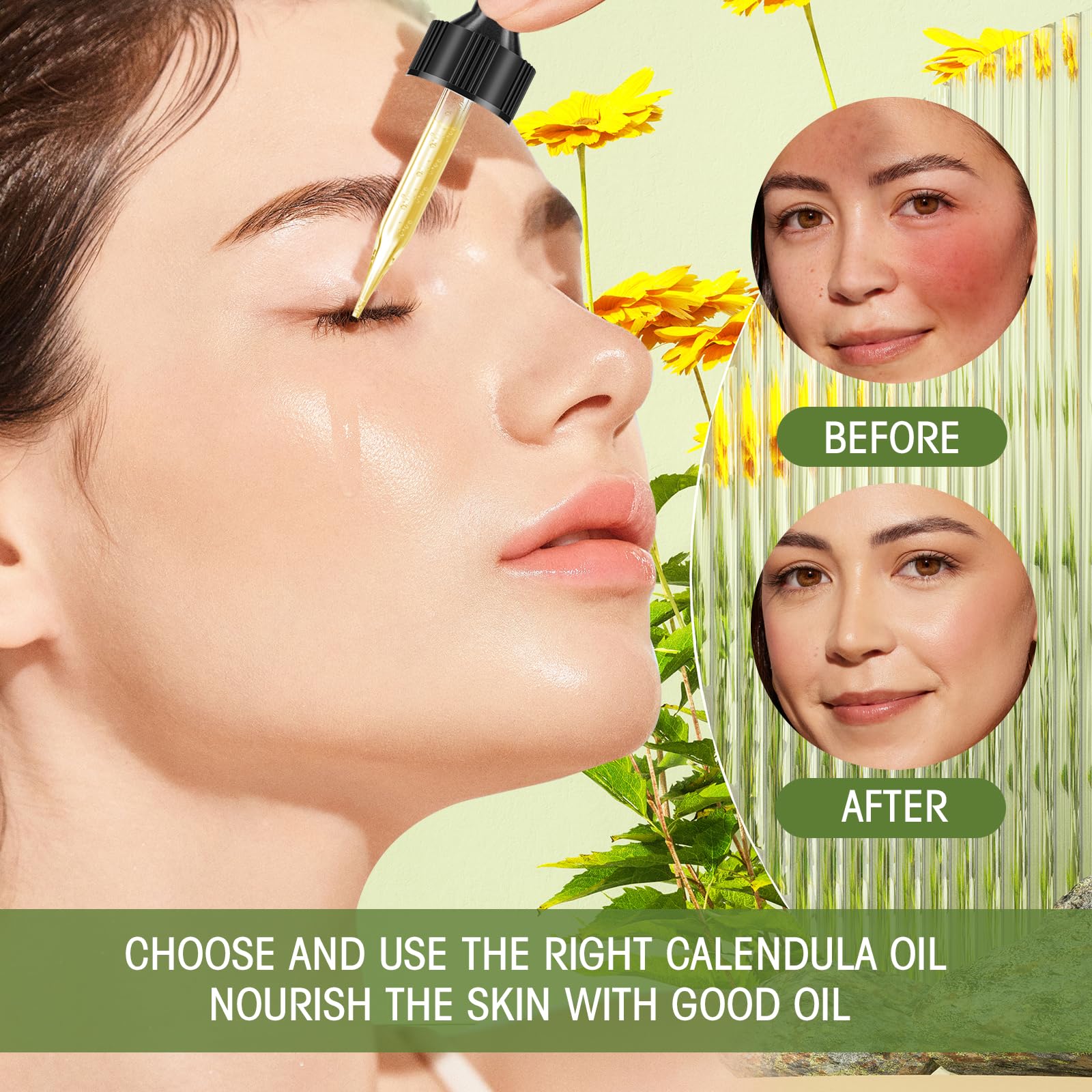 Calendula Oil – Natural Moisturizer for Anti-Aging & Soothing Skin Care