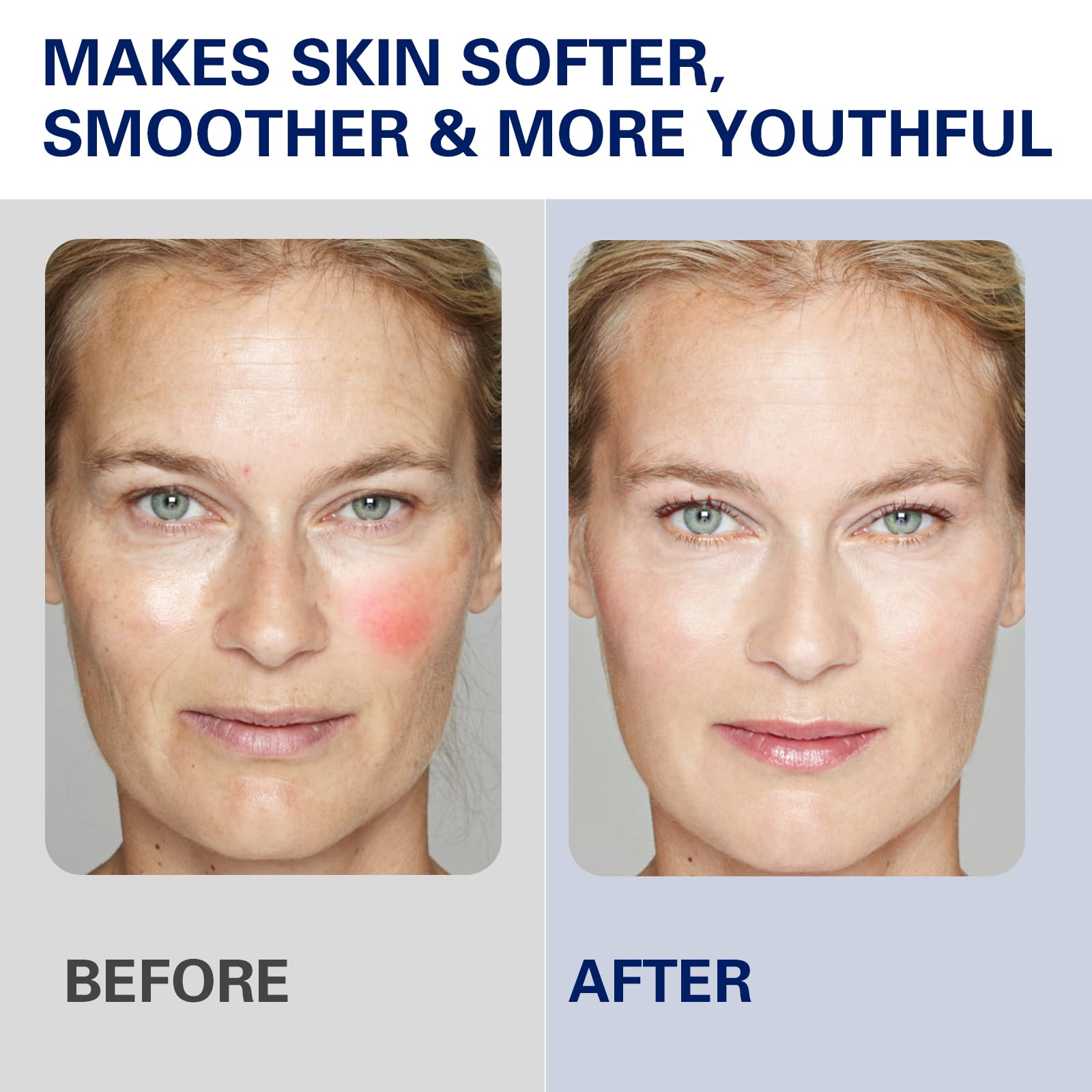 Organic Beef Tallow Cream – Whipped Moisturizer for Face & Body