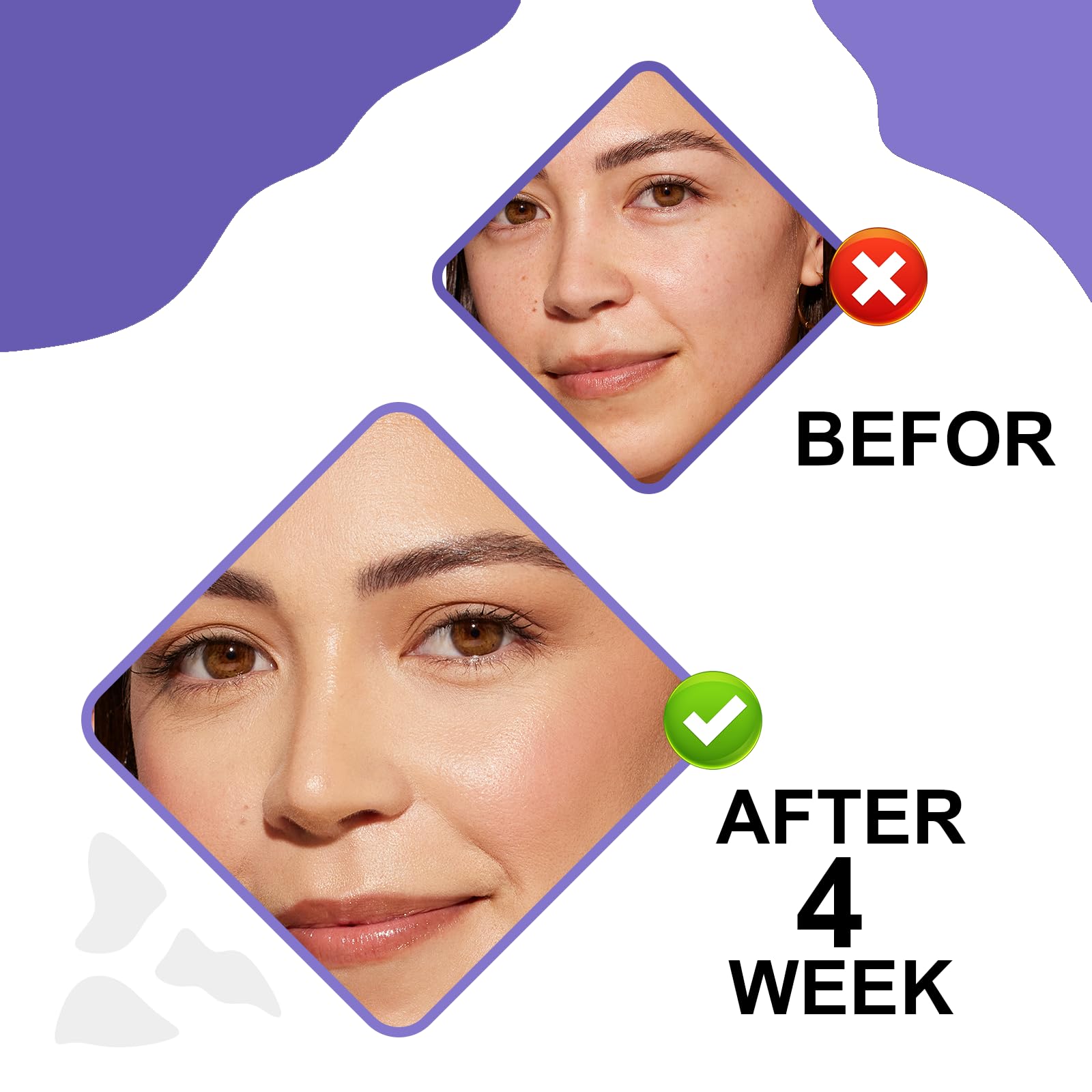 Retinol & Hyaluronic Night Cream – Anti-Aging Face Moisturizer